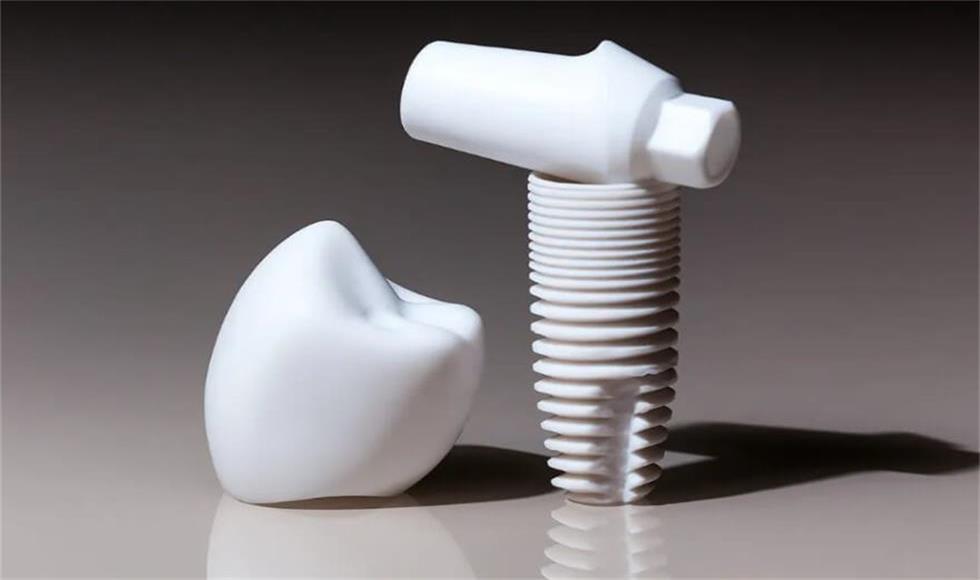 Ceramic Dental Implants: An Emerging Method for Restoring Teeth