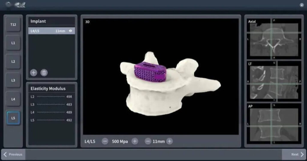 3d printing ceramics