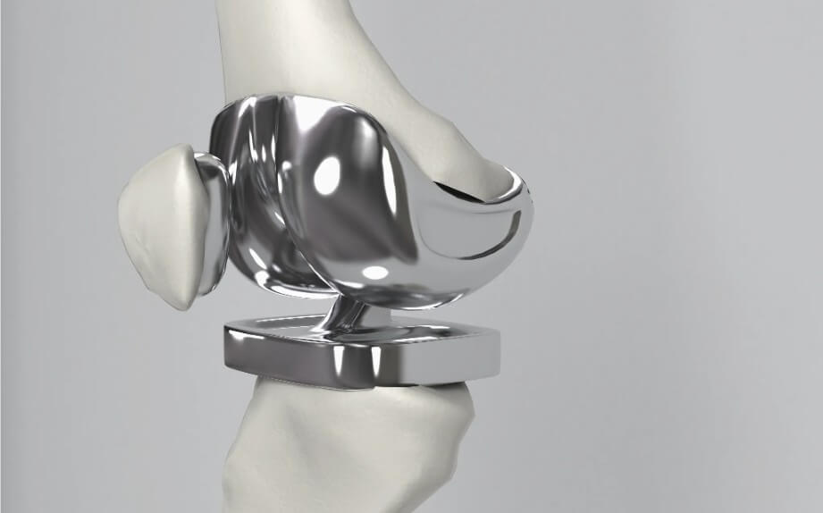 cnc precision machining parts-artificial joints